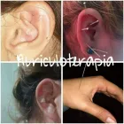 La imagen 1 de la Empresa AURICULOTERAPIA MYREN CINTIA MORIALE Reiki terapeutico en Merlo AR-B