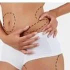 La imagen 7 de la Empresa CATALINA DRAZETA ESTÉTICA CORPORAL Ultracavitación en Olavarría AR-B