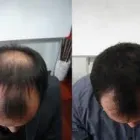 La imagen 2 de la Empresa DOCTOR MARCELO RODRIGUEZ Nutricion en Luján de Cuyo AR-M	