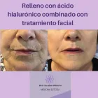 La imagen 2 de la Empresa DR.CAROLINA ODORICO MEDICINA ESTÉTICA Rejuvenecimiento Facial en Mendoza AR-M	
