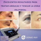 La imagen 4 de la Empresa DR.CAROLINA ODORICO MEDICINA ESTÉTICA Rejuvenecimiento Facial en Mendoza AR-M	