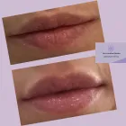 La imagen 5 de la Empresa DR.CAROLINA ODORICO MEDICINA ESTÉTICA Rejuvenecimiento Facial en Mendoza AR-M	