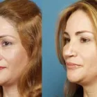 La imagen 1 de la Empresa DR MIGUEL AVRAMOVIC. FLEBOLOGÍA Y ESTÉTICA Vitaminas en Buenos Aires Argentina