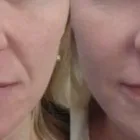 La imagen 2 de la Empresa DR MIGUEL AVRAMOVIC. FLEBOLOGÍA Y ESTÉTICA Vitaminas en Buenos Aires Argentina