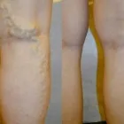 La imagen 4 de la Empresa DR MIGUEL AVRAMOVIC. FLEBOLOGÍA Y ESTÉTICA Vitaminas en Buenos Aires Argentina