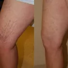 La imagen 5 de la Empresa DR MIGUEL AVRAMOVIC. FLEBOLOGÍA Y ESTÉTICA Vitaminas en Buenos Aires Argentina