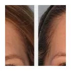 La imagen 8 de la Empresa DR MIGUEL AVRAMOVIC. FLEBOLOGÍA Y ESTÉTICA Vitaminas en Buenos Aires Argentina