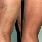 La imagen 9 de la Empresa DR MIGUEL AVRAMOVIC. FLEBOLOGÍA Y ESTÉTICA Vitaminas en Buenos Aires Argentina