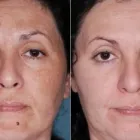 La imagen 10 de la Empresa DR MIGUEL AVRAMOVIC. FLEBOLOGÍA Y ESTÉTICA Vitaminas en Buenos Aires Argentina