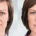 La imagen 11 de la Empresa DR MIGUEL AVRAMOVIC. FLEBOLOGÍA Y ESTÉTICA Vitaminas en Buenos Aires Argentina