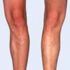 La imagen 13 de la Empresa DR MIGUEL AVRAMOVIC. FLEBOLOGÍA Y ESTÉTICA Vitaminas en Buenos Aires Argentina