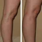 La imagen 16 de la Empresa DR MIGUEL AVRAMOVIC. FLEBOLOGÍA Y ESTÉTICA Vitaminas en Buenos Aires Argentina