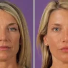 La imagen 17 de la Empresa DR MIGUEL AVRAMOVIC. FLEBOLOGÍA Y ESTÉTICA Vitaminas en Buenos Aires Argentina