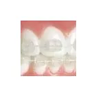 La imagen 3 de la Empresa DRA. MANFRIN - ORTODONCIA MAR DEL PLATA Protésico dental en Mar del Plata AR-B