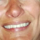 La imagen 2 de la Empresa DRA. NATALIA PAZ Tratamientos Esteticos en Mar del Plata AR-B