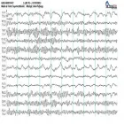 La imagen 1 de la Empresa ELECTROENCEFALOGRAMAS - VIDEO EEG - POLISOMNOGRAFÍAS - NEUROMAND ESTUDIOS NEUROLÓGICOS Neurologia en Capital Federal AR-B