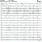 La imagen 2 de la Empresa ELECTROENCEFALOGRAMAS - VIDEO EEG - POLISOMNOGRAFÍAS - NEUROMAND ESTUDIOS NEUROLÓGICOS Neurologia en Capital Federal AR-B