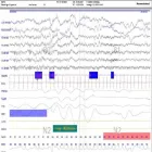La imagen 3 de la Empresa ELECTROENCEFALOGRAMAS - VIDEO EEG - POLISOMNOGRAFÍAS - NEUROMAND ESTUDIOS NEUROLÓGICOS Neurologia en Capital Federal AR-B
