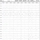 La imagen 4 de la Empresa ELECTROENCEFALOGRAMAS - VIDEO EEG - POLISOMNOGRAFÍAS - NEUROMAND ESTUDIOS NEUROLÓGICOS Neurologia en Capital Federal AR-B