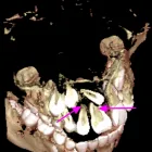 La imagen 3 de la Empresa KRANEX - RADIOLOGIA ODONTOLOGICA Radiografias en Neuquén AR-Q