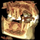 La imagen 5 de la Empresa KRANEX - RADIOLOGIA ODONTOLOGICA Radiografias en Neuquén AR-Q