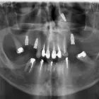 La imagen 6 de la Empresa KRANEX - RADIOLOGIA ODONTOLOGICA Radiografias en Neuquén AR-Q