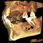 La imagen 2 de la Empresa KRANEX - RADIOLOGIA ODONTOLOGICA Radiografias en Neuquén AR-Q
