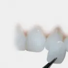 La imagen 2 de la Empresa LABORATORIO ASDENTAL - PROTESIS DENTALES Laboratorio de Protesis Dental en Buenos Aires Argentina