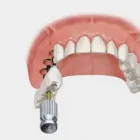 La imagen 3 de la Empresa LABORATORIO ASDENTAL - PROTESIS DENTALES Laboratorio de Protesis Dental en Buenos Aires Argentina