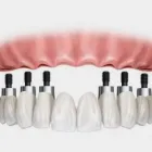 La imagen 4 de la Empresa LABORATORIO ASDENTAL - PROTESIS DENTALES Laboratorio de Protesis Dental en Buenos Aires Argentina