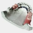 La imagen 11 de la Empresa LABORATORIO ASDENTAL - PROTESIS DENTALES Laboratorio de Protesis Dental en Buenos Aires Argentina