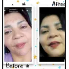 La imagen 6 de la Empresa MEDICINA ESTÉTICA DRA. NOELIA VILLENA Tratamiento para Celulitis en Morón AR-B