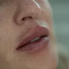 La imagen 3 de la Empresa MONTENEGRO MERCEDES ARMONIZACIÓN OROFACIAL Medicina Estetica en Oberá AR-N	