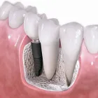 La imagen 1 de la Empresa ODONTOLOGIA INTEGRAL DR YUBEIKER HERRERA Ortodoncia en Castelar AR-B
