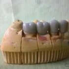 La imagen 3 de la Empresa ODONTOLOGIA PRIVADA INTEGRAL OPAT Tratamiento Endodontico en Capital Federal AR-B