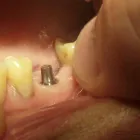 La imagen 6 de la Empresa ODONTOLOGIA PRIVADA INTEGRAL OPAT Tratamiento Endodontico en Capital Federal AR-B