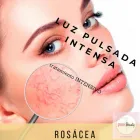 La imagen 3 de la Empresa PINK BEAUTY Varices en Capital Federal AR-B