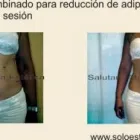 La imagen 2 de la Empresa SALUTARIS MEDICINA ESTÉTICA Ultracavitación en Mar del Plata AR-B