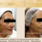 La imagen 4 de la Empresa SALUTARIS MEDICINA ESTÉTICA Ultracavitación en Mar del Plata AR-B