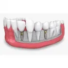 La imagen 2 de la Empresa URQUIZA DENTAL Tratamiento de Conducto en Capital Federal AR-B