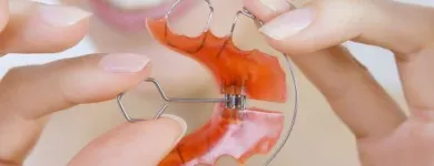 La imagen 3 de la Empresa CLÍNICA ODONTOLÓGICA DRA. MARCELA LISI Ortodoncia en Mendoza AR-M	