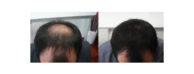 La imagen 2 de la Empresa DOCTOR MARCELO RODRIGUEZ Nutricion en Luján de Cuyo AR-M	