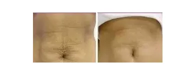 La imagen 4 de la Empresa DOCTOR MARCELO RODRIGUEZ Nutricion en Luján de Cuyo AR-M	