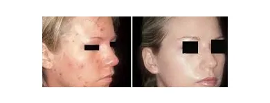 La imagen 7 de la Empresa DOCTOR MARCELO RODRIGUEZ Nutricion en Luján de Cuyo AR-M	