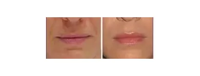 La imagen 8 de la Empresa DOCTOR MARCELO RODRIGUEZ Nutricion en Luján de Cuyo AR-M	