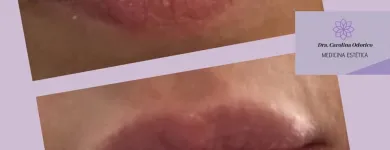 La imagen 5 de la Empresa DR.CAROLINA ODORICO MEDICINA ESTÉTICA Rejuvenecimiento Facial en Mendoza AR-M	
