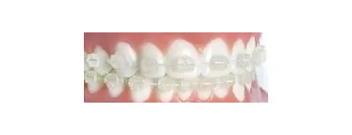 La imagen 3 de la Empresa DRA. MANFRIN - ORTODONCIA MAR DEL PLATA Protésico dental en Mar del Plata AR-B
