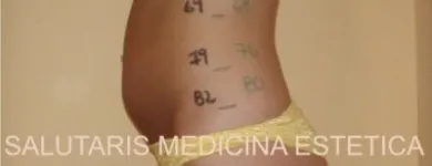 La imagen 3 de la Empresa SALUTARIS MEDICINA ESTÉTICA Ultracavitación en Mar del Plata AR-B
