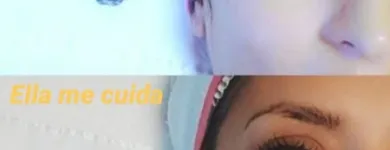 La imagen 1 de la Empresa VIRGINIA PAILLACAR ESTETICA SALUDABLE Lifting sin Cirugías en Neuquén AR-Q