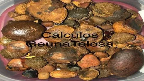 La imagen 2 de la Empresa CALCULOS BILIARES  BOVINOS